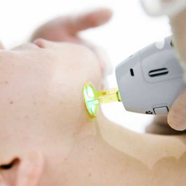 レーザー脱毛器の特性を生かした痛みの低減化